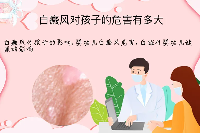 白癜风对孩子的危害有多大