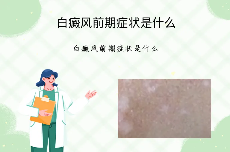 白癜风前期症状是什么