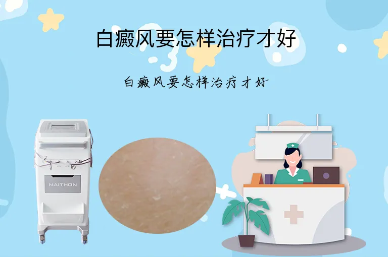 白癜风要怎样治疗才好