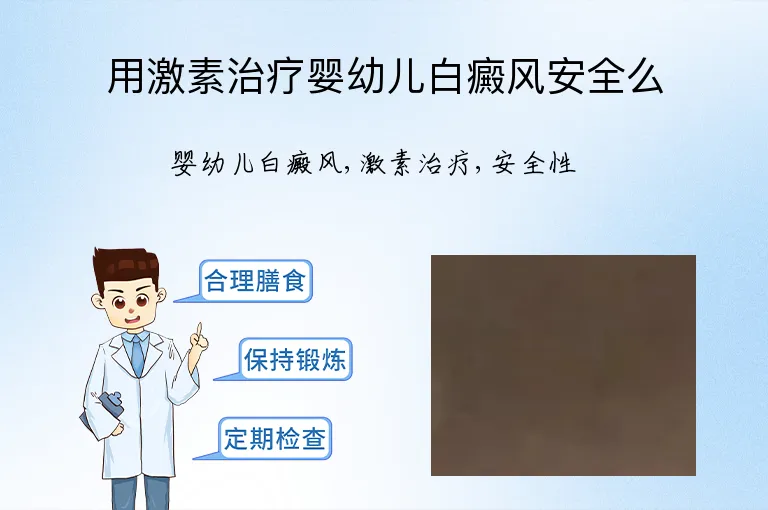 用激素治疗婴幼儿白癜风安全么