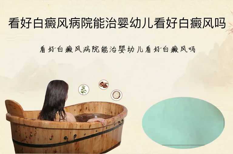 看好白癜风病院能治婴幼儿看好白癜风吗