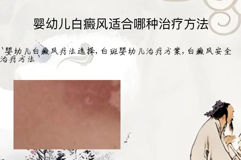 婴幼儿白癜风适合哪种治疗方法