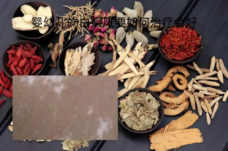 婴幼儿的白癜风要如何治疗会好