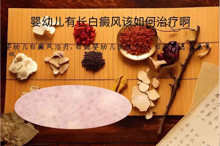 婴幼儿有长白癜风该如何治疗啊