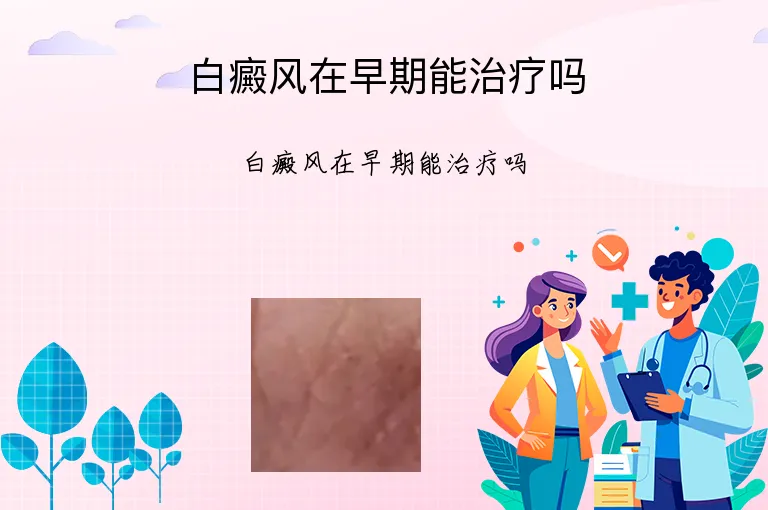 白癜风在早期能治疗吗