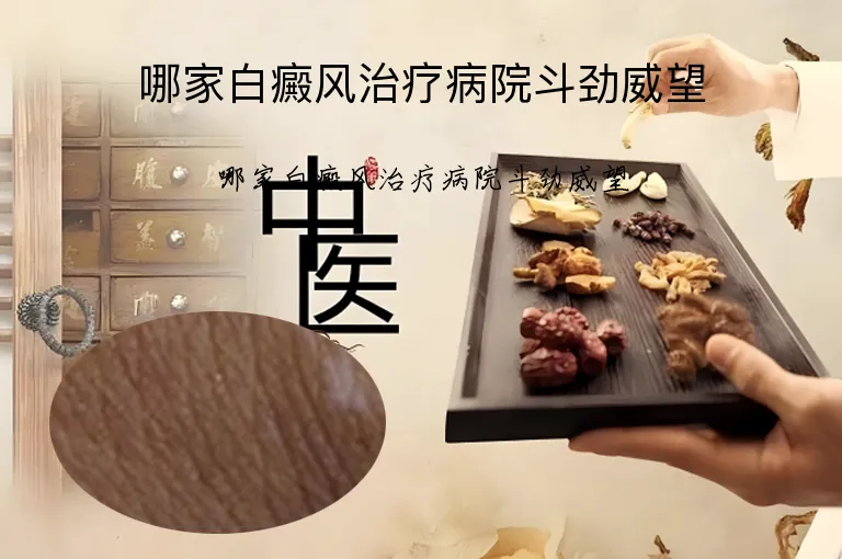 哪家白癜风治疗病院斗劲威望