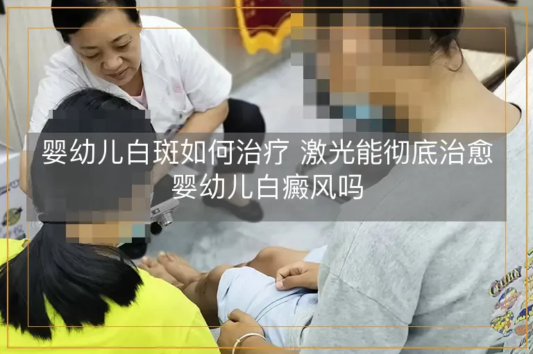 婴幼儿白斑如何治疗 激光能彻底治愈婴幼儿白癜风吗