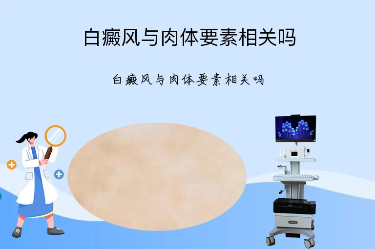 白癜风与肉体要素相关吗