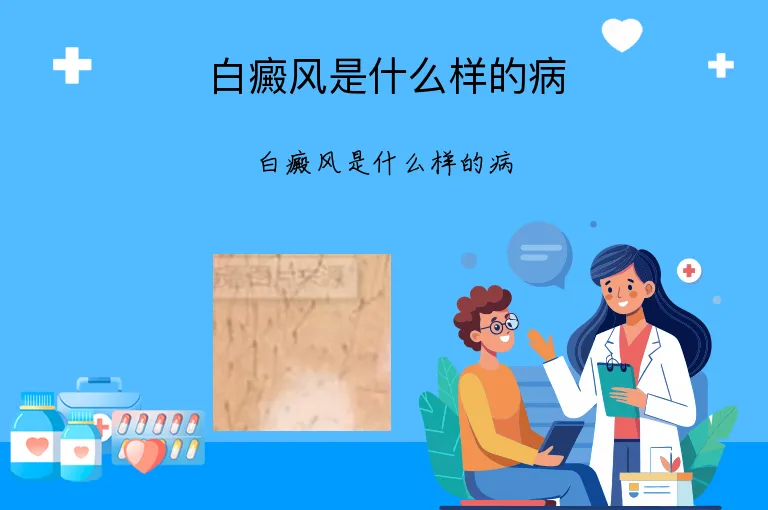 白癜风是什么样的病
