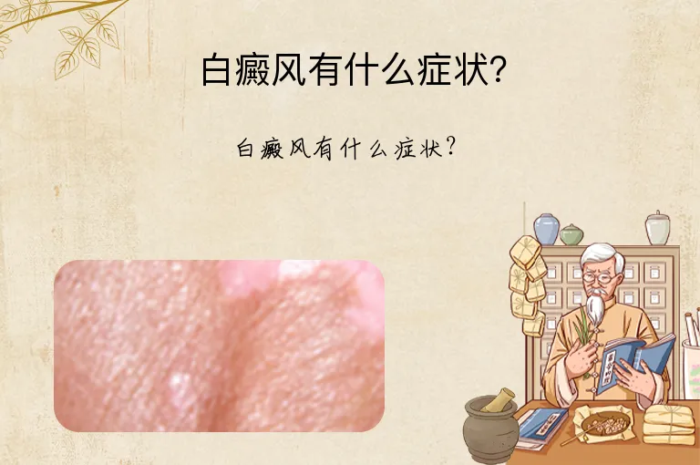 白癜风有什么症状？