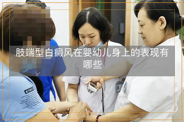 肢端型白癜风在婴幼儿身上的表现有哪些