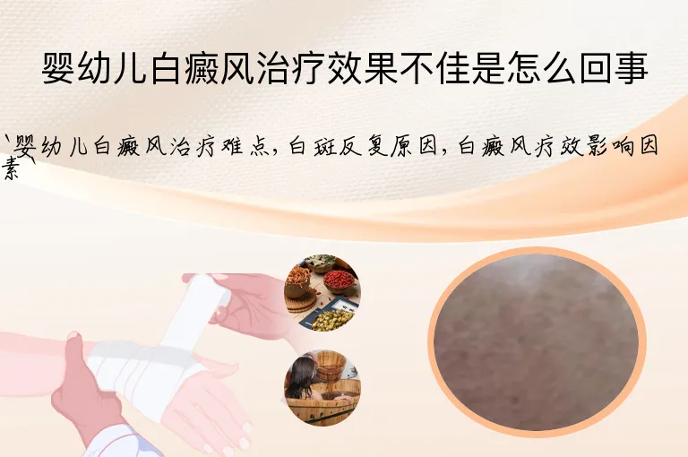 婴幼儿白癜风治疗效果不佳是怎么回事