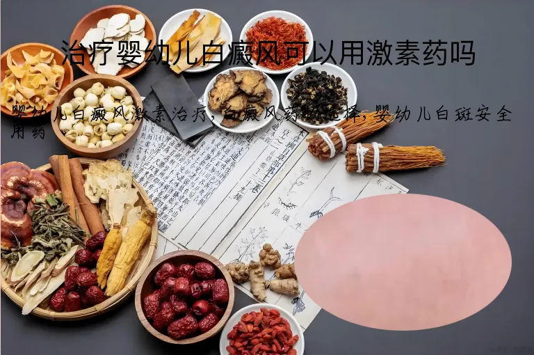 治疗婴幼儿白癜风可以用激素药吗