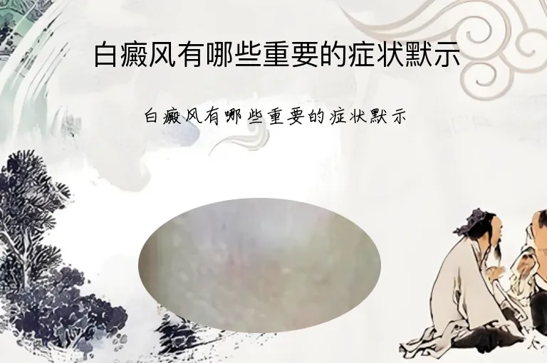 白癜风有哪些重要的症状默示