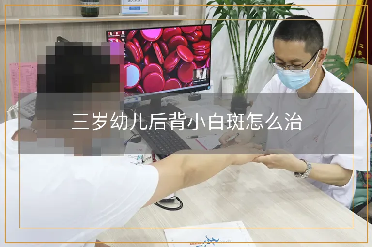 三岁幼儿后背小白斑怎么治
