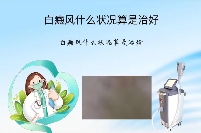 白癜风什么状况算是治好