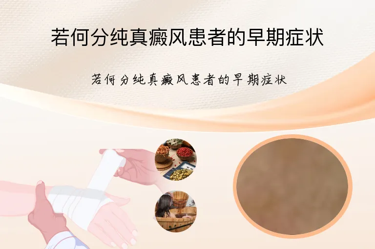 若何分纯真癜风患者的早期症状
