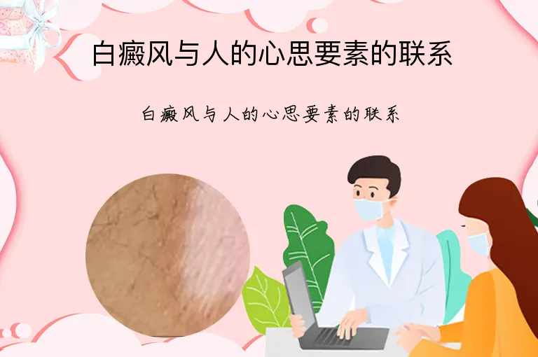 白癜风与人的心思要素的联系