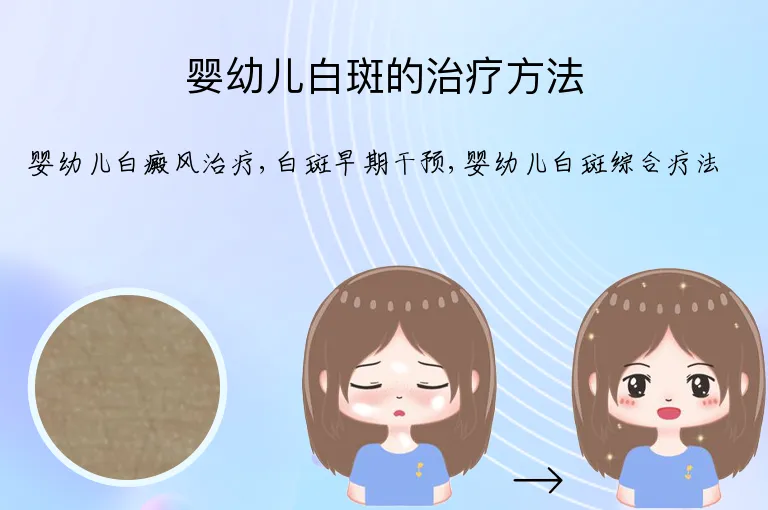 婴幼儿白斑的治疗方法