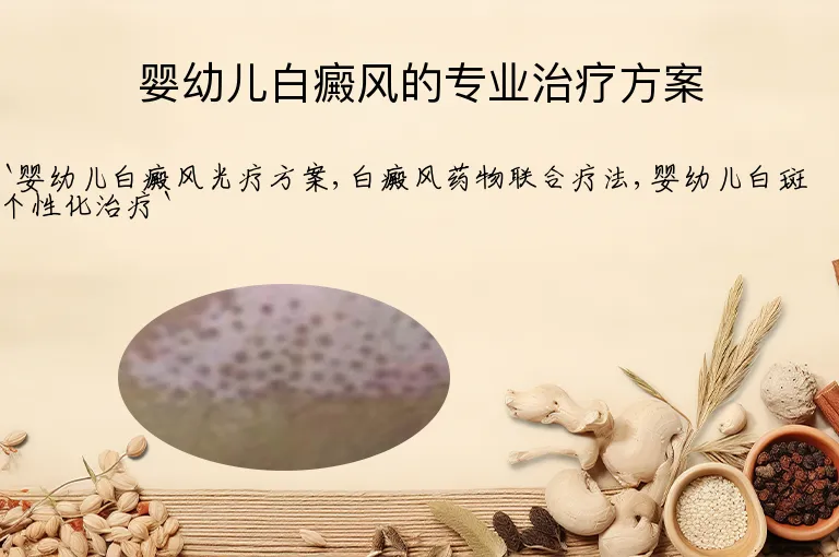 婴幼儿白癜风的专业治疗方案