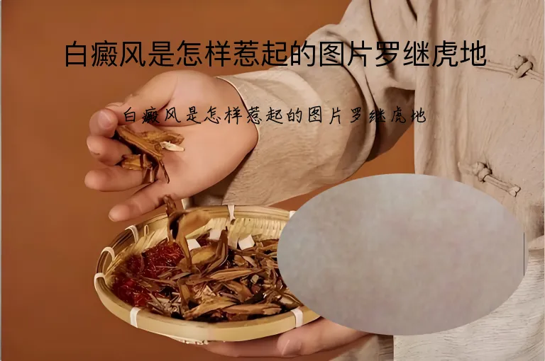白癜风是怎样惹起的图片罗继虎地