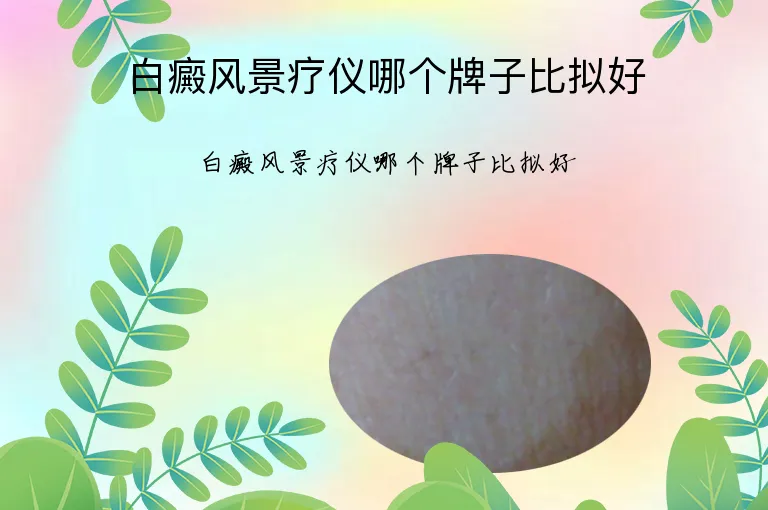 白癜风景疗仪哪个牌子比拟好