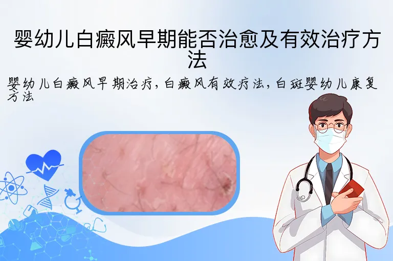 婴幼儿白癜风早期能否治愈及有效治疗方法