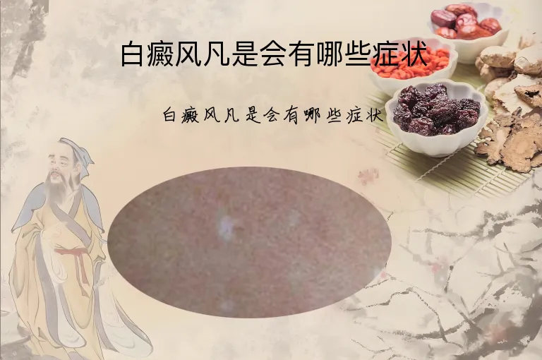 白癜风凡是会有哪些症状