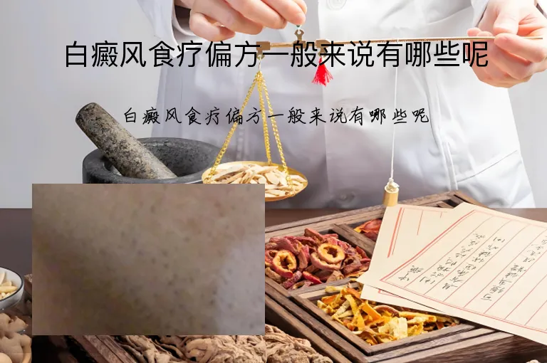 白癜风食疗偏方一般来说有哪些呢