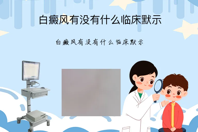 白癜风有没有什么临床默示