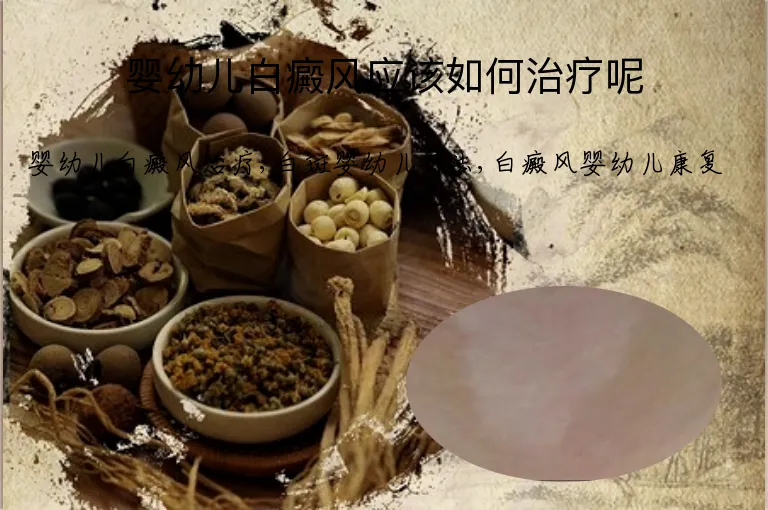 婴幼儿白癜风应该如何治疗呢