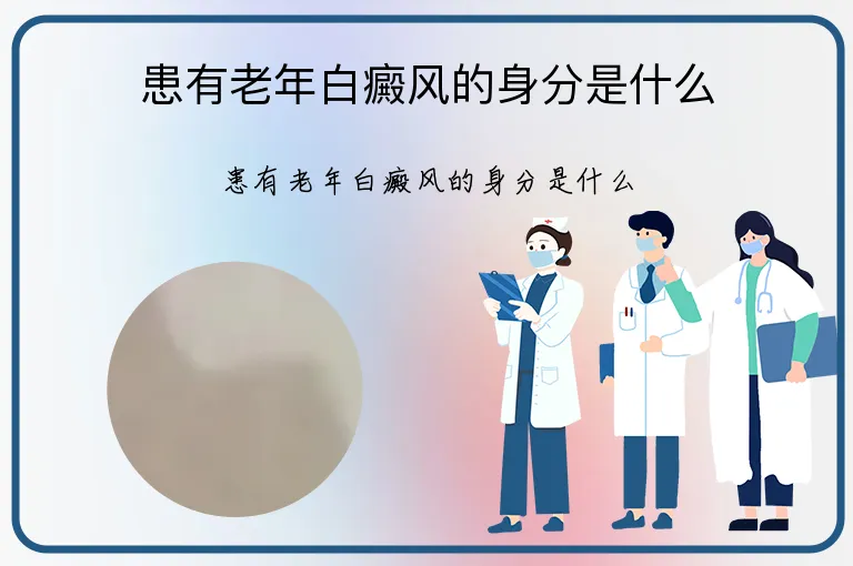 患有老年白癜风的身分是什么