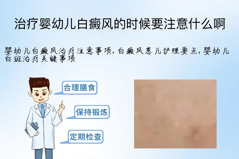 治疗婴幼儿白癜风的时候要注意什么啊