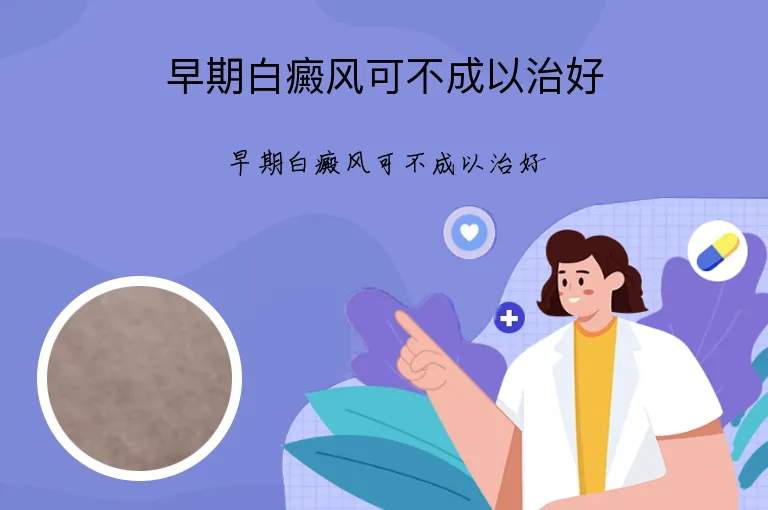 早期白癜风可不成以治好