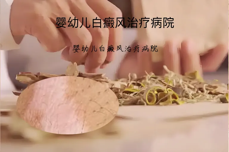 婴幼儿白癜风治疗病院