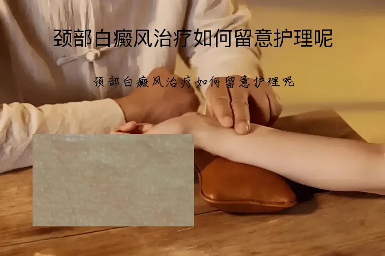 颈部白癜风治疗如何留意护理呢