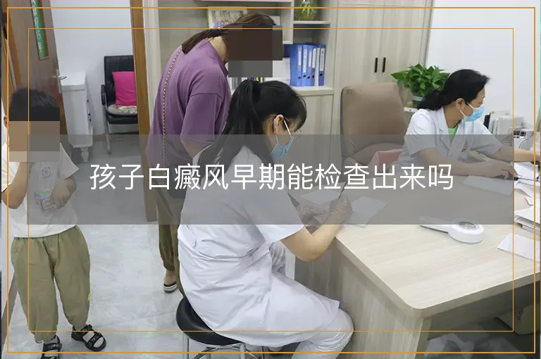 孩子白癜风早期能检查出来吗
