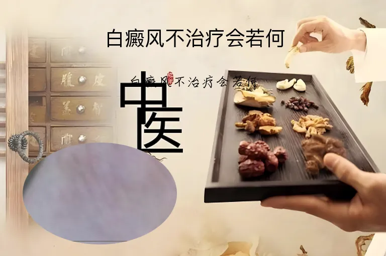 白癜风不治疗会若何