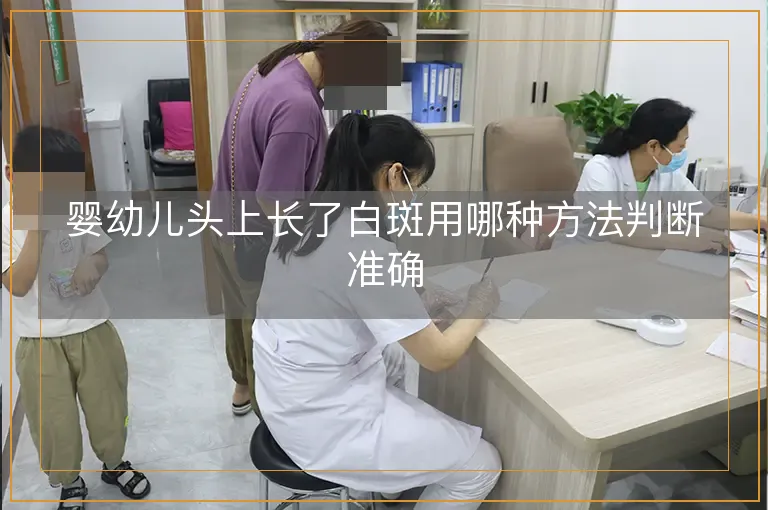 婴幼儿头上长了白斑用哪种方法判断准确