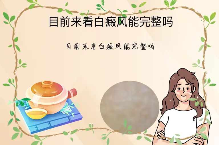目前来看白癜风能完整吗