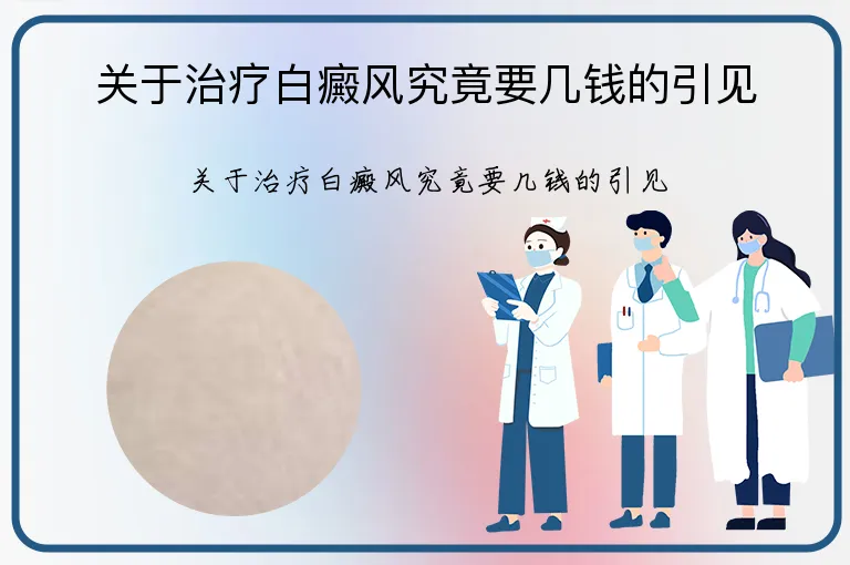 关于治疗白癜风究竟要几钱的引见