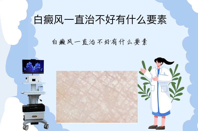 白癜风一直治不好有什么要素