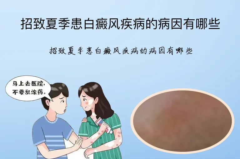 招致夏季患白癜风疾病的病因有哪些