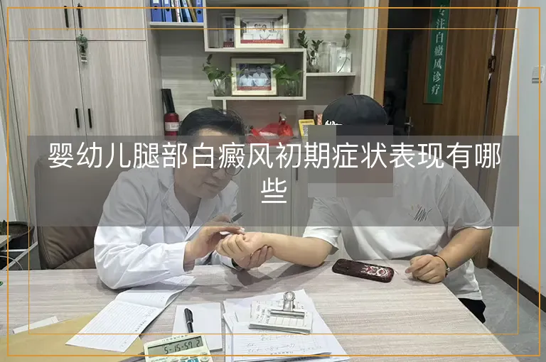 婴幼儿腿部白癜风初期症状表现有哪些