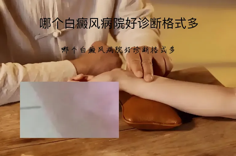 哪个白癜风病院好诊断格式多