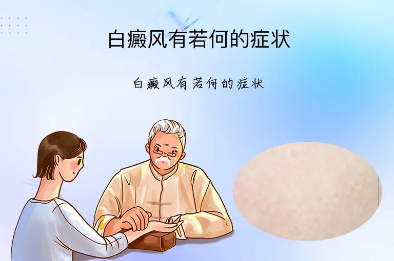 白癜风有若何的症状