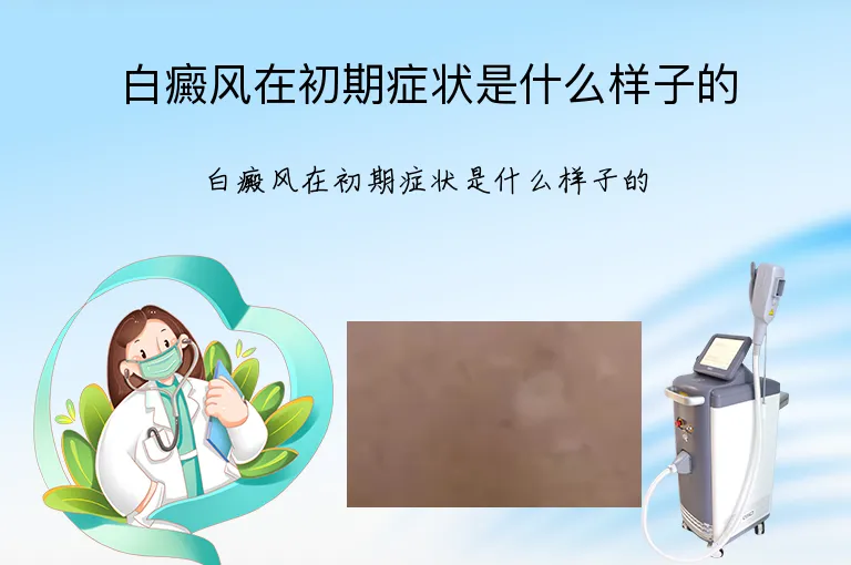 白癜风在初期症状是什么样子的
