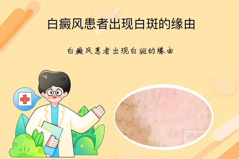 白癜风患者出现白斑的缘由