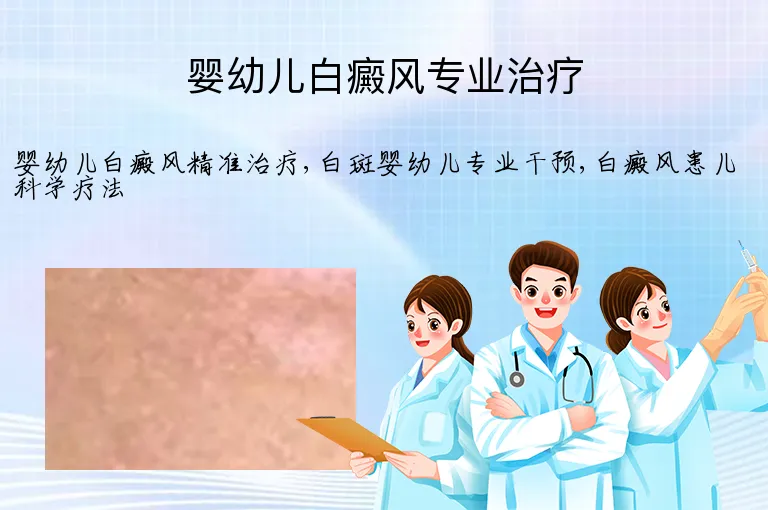 婴幼儿白癜风专业治疗