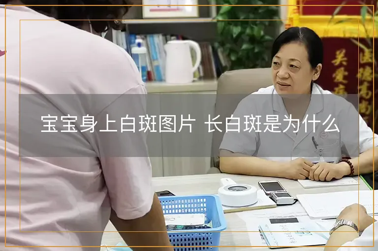 宝宝身上白斑图片 长白斑是为什么